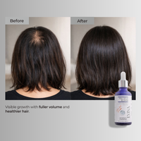Follicle Elixir Hair Growth Serum