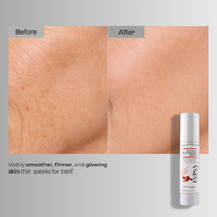 Molecular Rejuvenating Complex – Anti Ageing Exosome Gel Cream