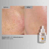 Liposomal Radiance Complex Serum